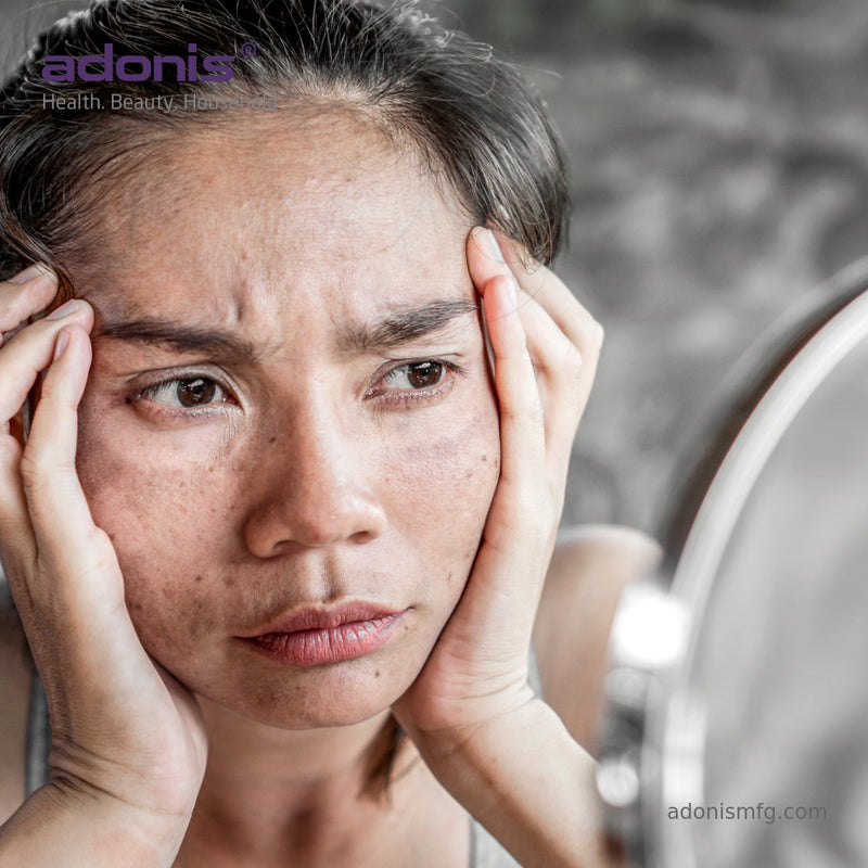 The Role of Active Ingredients in Acne Cream and Their Impact on Skin Health