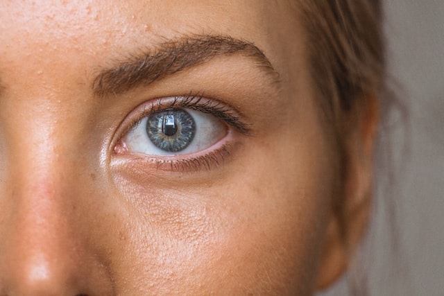 What causes dark under eye circles? And how to cover them up